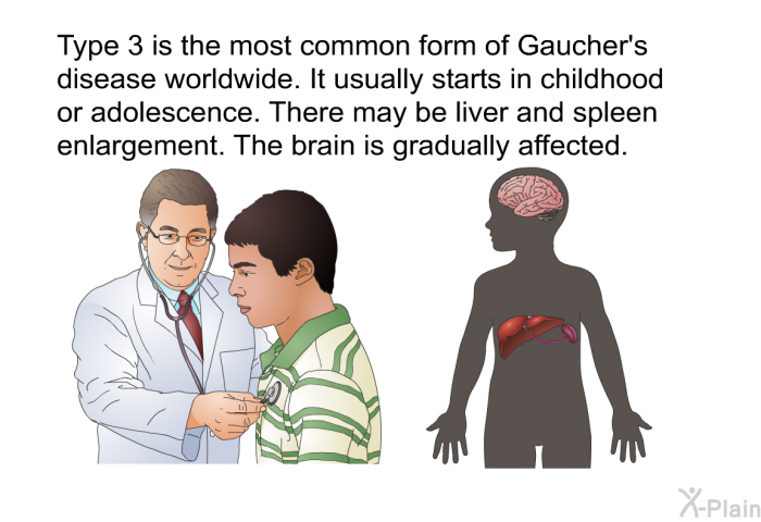 Type 3 is the most common form of Gaucher's disease worldwide. It usually starts in childhood or adolescence. There may be liver and spleen enlargement. The brain is gradually affected.