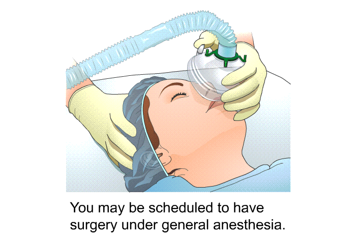 You may be scheduled to have surgery under general anesthesia.