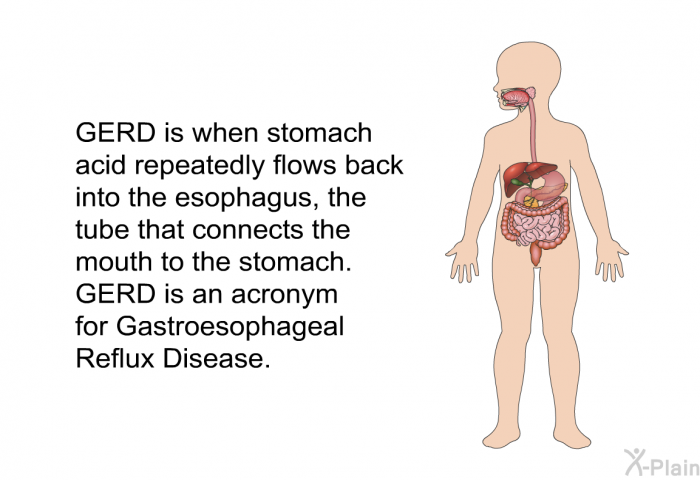 GERD is when stomach acid repeatedly flows back into the esophagus, the tube that connects the mouth to the stomach. GERD is an acronym for Gastroesophageal Reflux Disease.