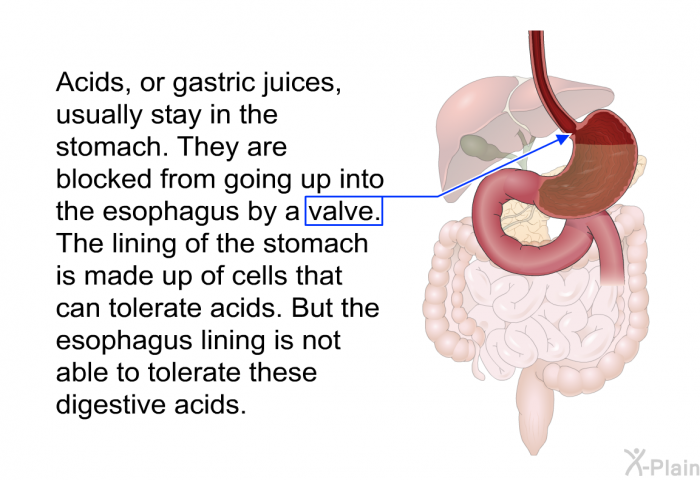 Acids, or gastric juices, usually stay in the stomach. They are blocked from going up into the esophagus by a valve. The lining of the stomach is made up of cells that can tolerate acids. But the esophagus lining is not able to tolerate these digestive acids.