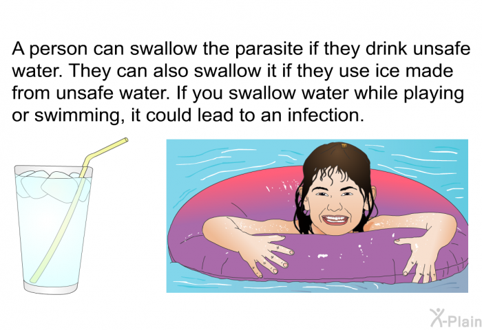 A person can swallow the parasite if they drink unsafe water. They can also swallow it if they use ice made from unsafe water. If you swallow water while playing or swimming, it could lead to an infection.