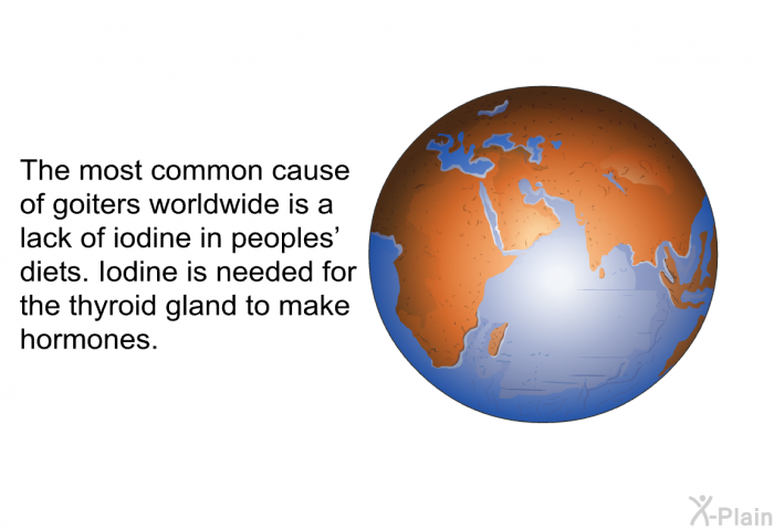 The most common cause of goiters worldwide is a lack of iodine in peoples' diets. Iodine is needed for the thyroid gland to make hormones.