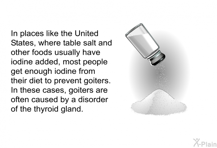 In places like the United States, where table salt and other foods usually have iodine added, most people get enough iodine from their diet to prevent goiters. In these cases, goiters are often caused by a disorder of the thyroid gland.