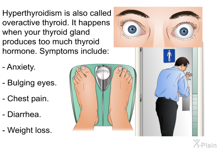 Hyperthyroidism is also called overactive thyroid. It happens when your thyroid gland produces too much thyroid hormone. Symptoms include:  Anxiety. Bulging eyes. Chest pain. Diarrhea. Weight loss.