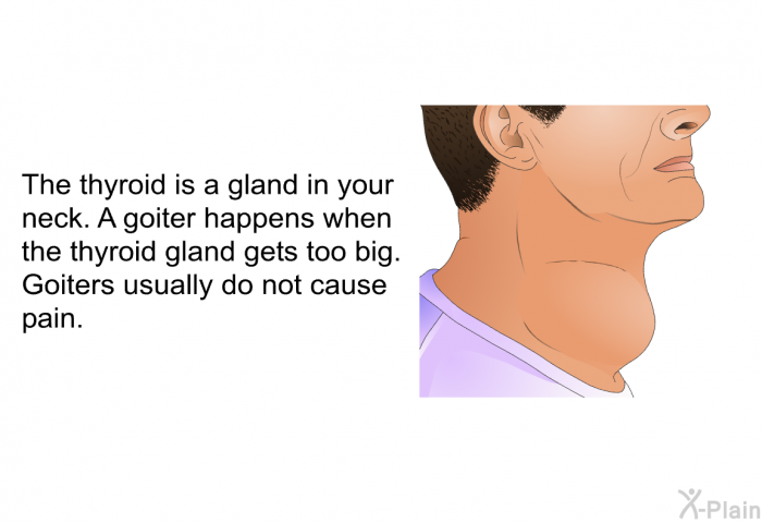 The thyroid is a gland in your neck. A goiter happens when the thyroid gland gets too big. Goiters usually do not cause pain.