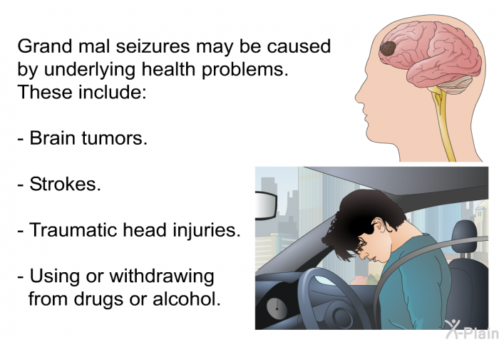 Grand mal seizures may be caused by underlying health problems. These include:  Brain tumors. Strokes. Traumatic head injuries. Using or withdrawing from drugs or alcohol.