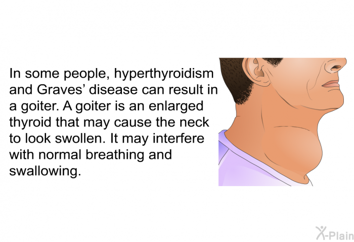 In some people, hyperthyroidism and Graves' disease can result in a goiter. A goiter is an enlarged thyroid that may cause the neck to look swollen. It may interfere with normal breathing and swallowing.