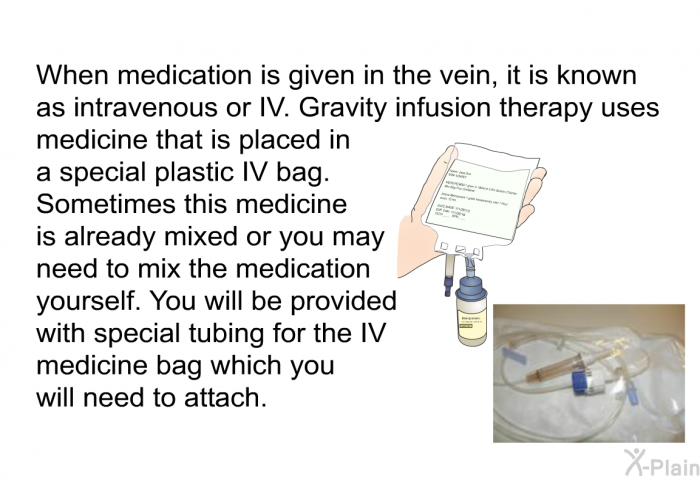 When medication is given in the vein, it is known as intravenous or IV. Gravity Infusion therapy uses medicine that is placed in a special plastic IV bag. Sometimes this medicine is already mixed or you may need to mix the medication yourself. You will be provided with special tubing for the IV medicine bag which you will need to attach.