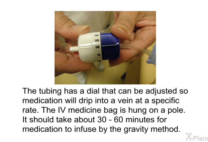 The tubing has a dial that can be adjusted so medication will drip into a vein at a specific rate. The IV medicine bag is hung on a pole. It should take about 30 - 60 minutes for medication to infuse by the gravity method.