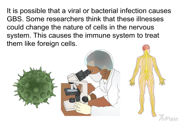 It is possible that a viral or bacterial infection causes GBS. Some researchers think that these illnesses could change the nature of cells in the nervous system. This causes the immune system to treat them like foreign cells.