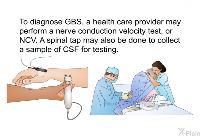 To diagnose GBS, a health care provider may perform a nerve conduction velocity test, or NCV. A spinal tap may also be done to collect a sample of CSF for testing.