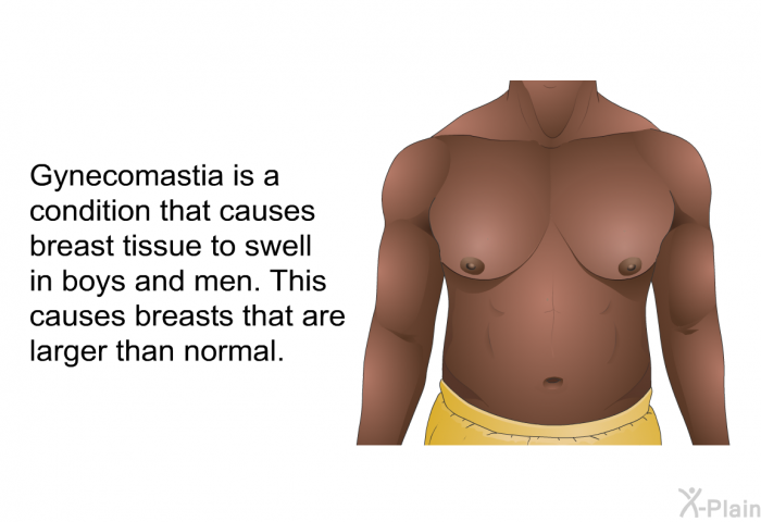 Gynecomastia is a condition that causes breast tissue to swell in boys and men. This causes breasts that are larger than normal.