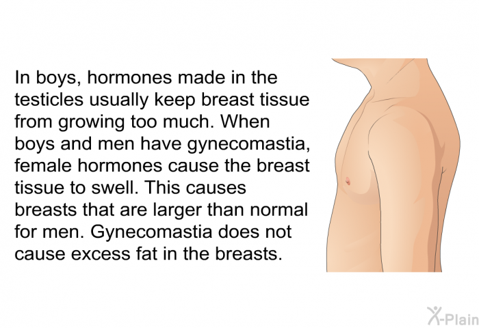 In boys, hormones made in the testicles usually keep breast tissue from growing too much. When boys and men have gynecomastia, female hormones cause the breast tissue to swell. This causes breasts that are larger than normal for men. Gynecomastia does not cause excess fat in the breasts.