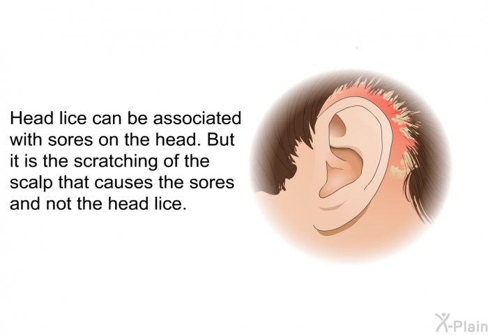 Head lice can be associated with sores on the head. But it is the scratching of the scalp that causes the sores and not the head lice.