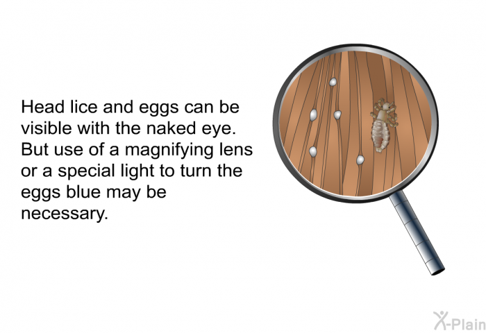 Head lice and eggs can be visible with the naked eye. But use of a magnifying lens or a special light to turn the eggs blue may be necessary.