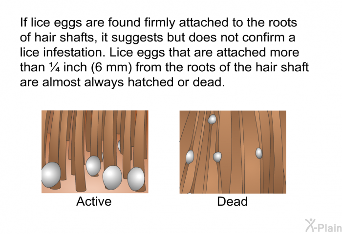 If lice eggs are found firmly attached to the roots of hair shafts, it suggests but does not confirm a lice infestation. Lice eggs that are attached more than &frac14; inch (6 mm) from the roots of the hair shaft are almost always hatched or dead.