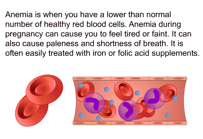 Anemia is when you have a lower than normal number of healthy red blood cells. Anemia during pregnancy can cause you to feel tired or faint. It can also cause paleness and shortness of breath. It is often easily treated with iron or folic acid supplements.