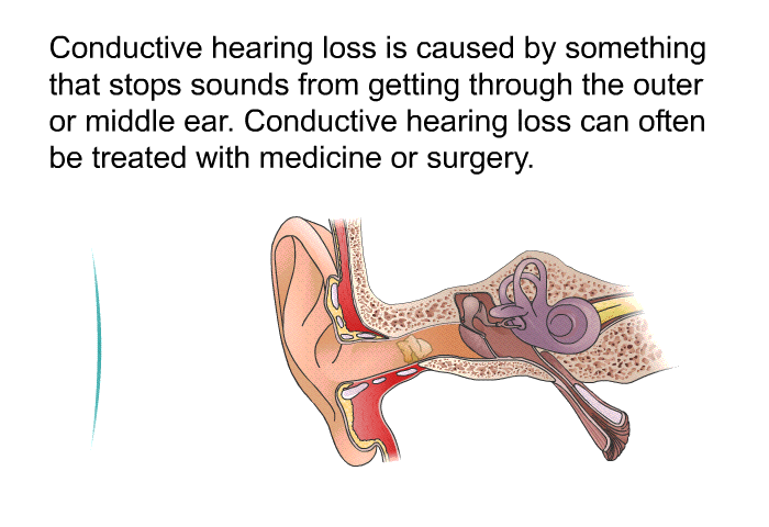 Conductive hearing loss is caused by something that stops sounds from getting through the outer or middle ear. Conductive hearing loss can often be treated with medicine or surgery.