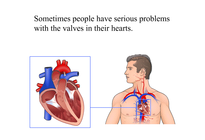 Sometimes people have serious problems with the valves in their hearts.
