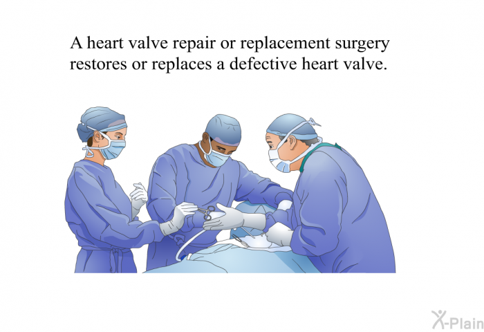 A heart valve repair or replacement surgery restores or replaces a defective heart valve.