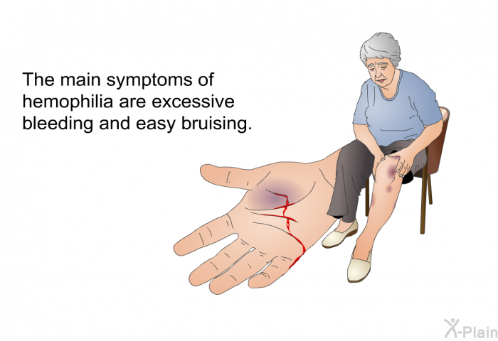 The main symptoms of hemophilia are excessive bleeding and easy bruising.