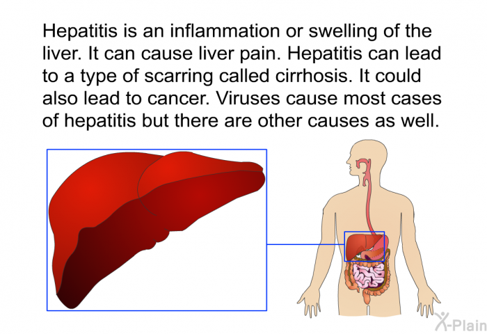 Hepatitis is an inflammation or swelling of the liver. It can cause liver pain. Hepatitis can lead to a type of scarring called cirrhosis. It could also lead to cancer. Viruses cause most cases of hepatitis but there are other causes as well.