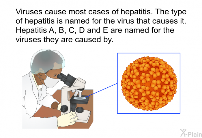 Viruses cause most cases of hepatitis. The type of hepatitis is named for the virus that causes it. Hepatitis A, B, C, D and E are named for the viruses they are caused by.