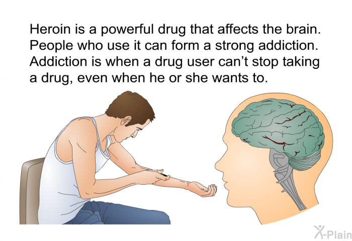 Heroin is a powerful drug that affects the brain. People who use it can form a strong addiction. Addiction is when a drug user can't stop taking a drug, even when he or she wants to.