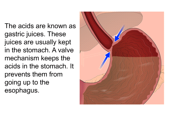 The acids are known as gastric juices. These juices are usually kept in the stomach. A valve mechanism keeps the acids in the stomach. It prevents them from going up to the esophagus.