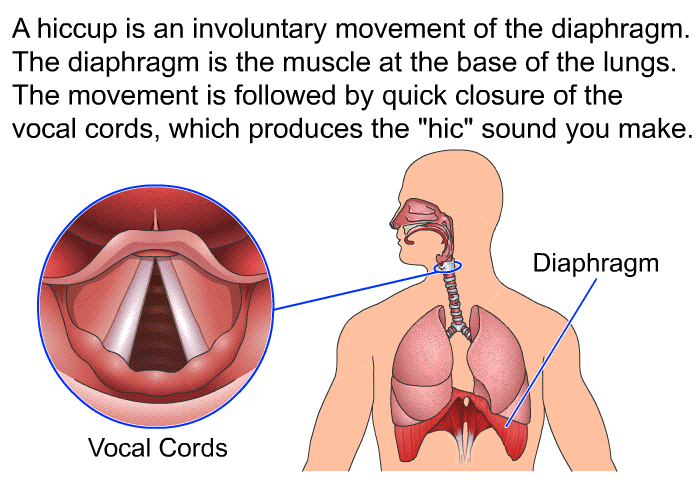 A hiccup is an involuntary movement of the diaphragm. The diaphragm is the muscle at the base of the lungs. The movement is followed by quick closure of the vocal cords, which produces the "hic" sound you make.