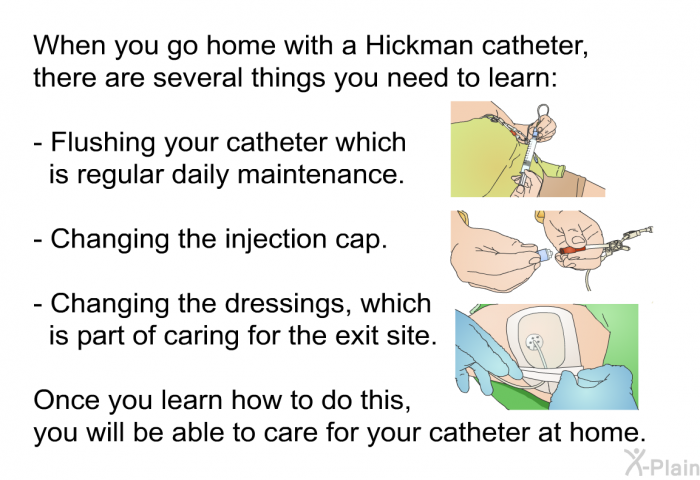 When you go home with a Hickman catheter, there are several things you need to learn:  Flushing your catheter which is regular daily maintenance. Changing the injection cap. Changing the dressings, which is part of caring for the exit site.  
 Once you learn how to do this, you will be able to care for your catheter at home.