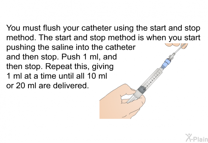 You must flush your catheter using the start and stop method. The start and stop method is when you start pushing the saline into the catheter and then stop. Push 1 ml, and then stop. Repeat this, giving 1 ml at a time until all 10 ml or 20 ml are delivered.