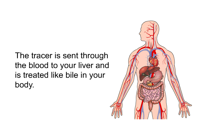 The tracer is sent through the blood to your liver and is treated like bile in your body.