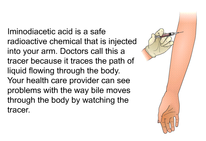 Iminodiacetic acid is a safe radioactive chemical that is injected into your arm. Doctors call this a tracer because it traces the path of liquid flowing through the body. Your health care provider can see problems with the way bile moves through the body by watching the tracer.