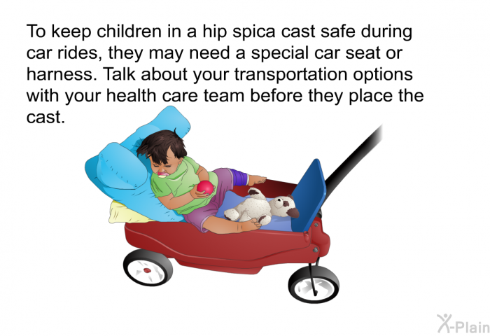 To keep children in a hip spica cast safe during car rides, they may need a special car seat or harness. Talk about your transportation options with your health care team before they place the cast.