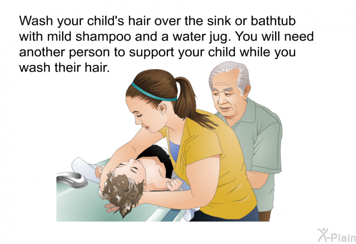 Wash your child's hair over the sink or bathtub with mild shampoo and a water jug. You will need another person to support your child while you wash their hair.