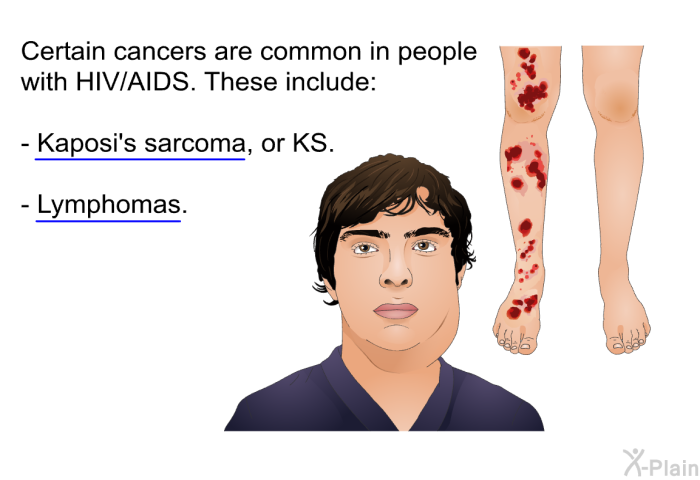 Certain cancers are common in people with HIV/AIDS. These include:  Kaposi's sarcoma, or KS. Lymphomas.