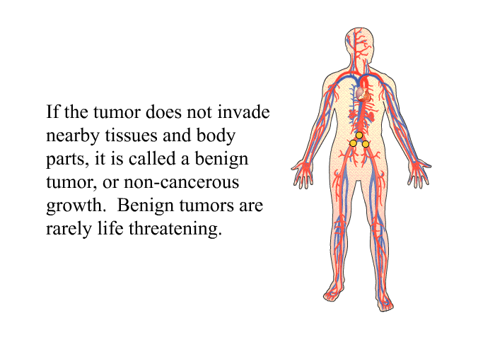 If the tumor does not invade nearby tissues and body parts, it is called a benign tumor, or non-cancerous growth. Benign tumors are rarely life threatening.