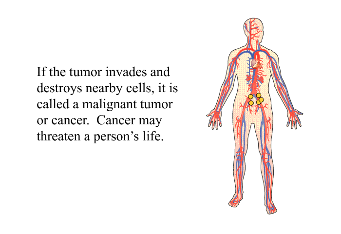 If the tumor invades and destroys nearby cells, it is called a malignant tumor or cancer. Cancer may threaten a person's life.