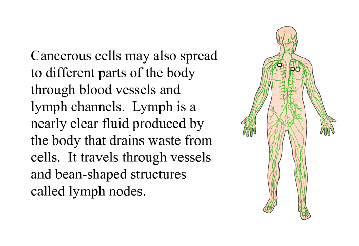 Cancerous cells may also spread to different parts of the body through blood vessels and lymph channels. Lymph is a nearly clear fluid produced by the body that drains waste from cells. It travels through vessels and bean-shaped structures called lymph nodes.