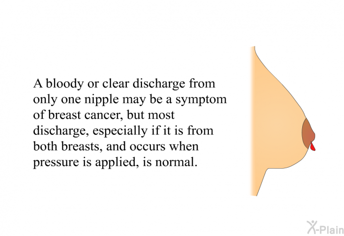 A bloody or clear discharge from only one nipple may be a symptom of breast cancer, but most discharge, especially if it is from both breasts, and occurs when pressure is applied, is normal.