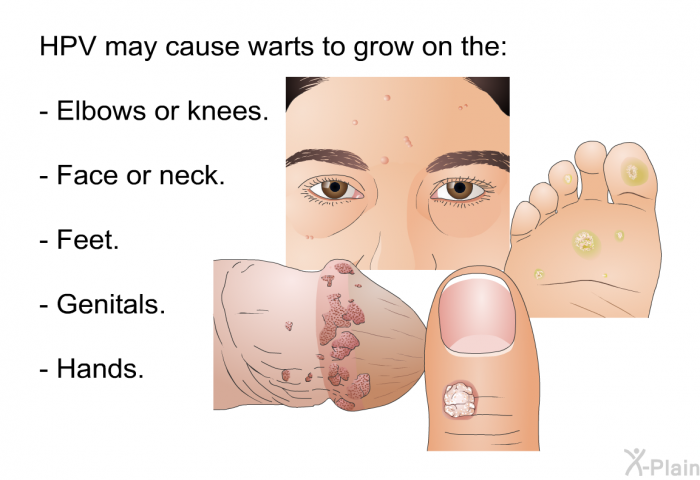 HPV may cause warts to grow on the:  Elbows or knees. Face or neck. Feet. Genitals. Hands.