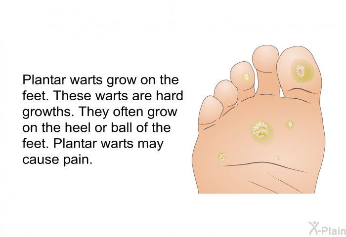 Plantar warts grow on the feet. These warts are hard growths. They often grow on the heel or ball of the feet. Plantar warts may cause pain.