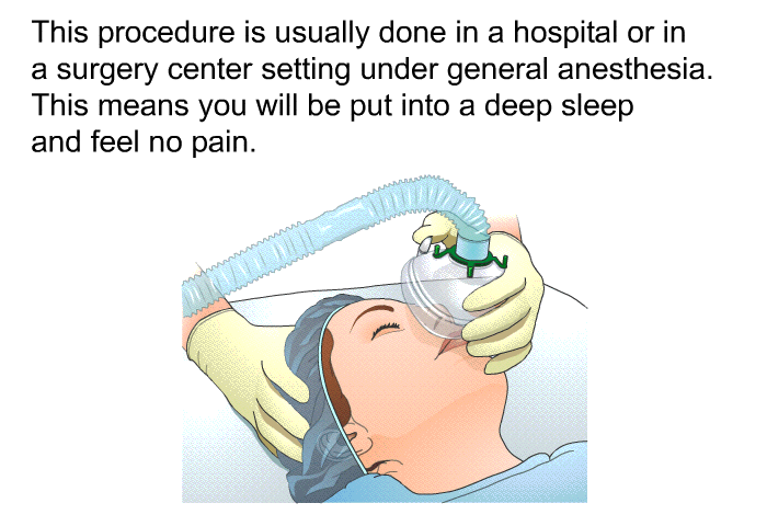 This procedure is usually done in a hospital or in a surgery center setting under general anesthesia. This means you will be put into a deep sleep and feel no pain.