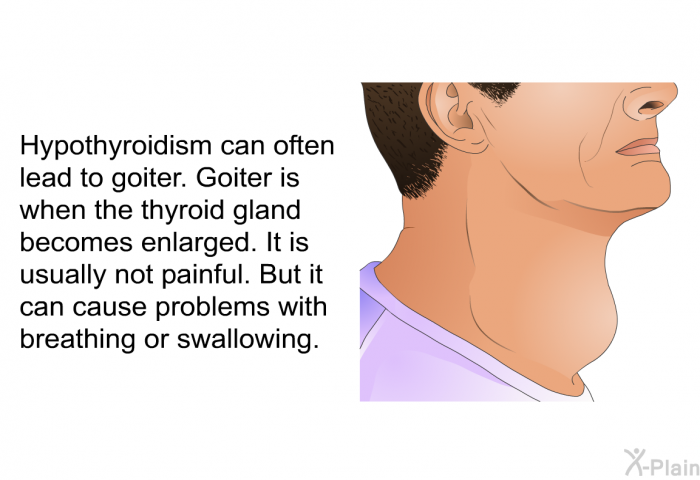 Hypothyroidism can often lead to goiter. Goiter is when the thyroid gland becomes enlarged. It is usually not painful. But it can cause problems with breathing or swallowing.