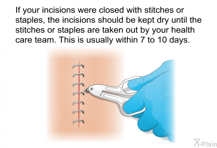 If your incisions were closed with stitches or staples, the incisions should be kept dry until the stitches or staples are taken out by your health care team. This is usually within 7 to 10 days.