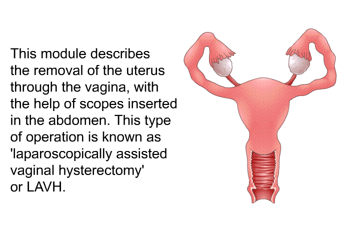 This health information describes the removal of the uterus through the vagina, with the help of scopes inserted in the abdomen. This type of operation is known as  laparoscopically assisted vaginal hysterectomy' or LAVH.