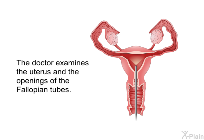 The doctor examines the uterus and the openings of the Fallopian tubes.