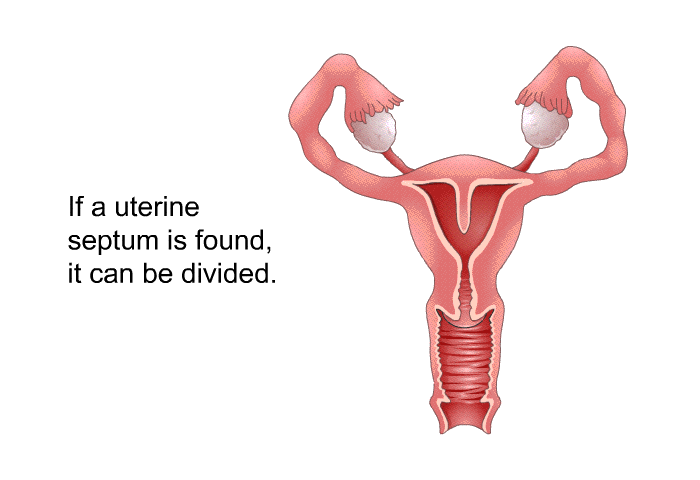 If a uterine septum is found, it can be divided.