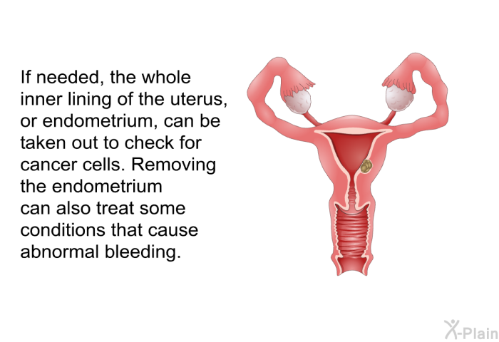 If needed, the whole inner lining of the uterus, or endometrium, can be taken out to check for cancer cells. Removing the endometrium can also treat some conditions that cause abnormal bleeding.
